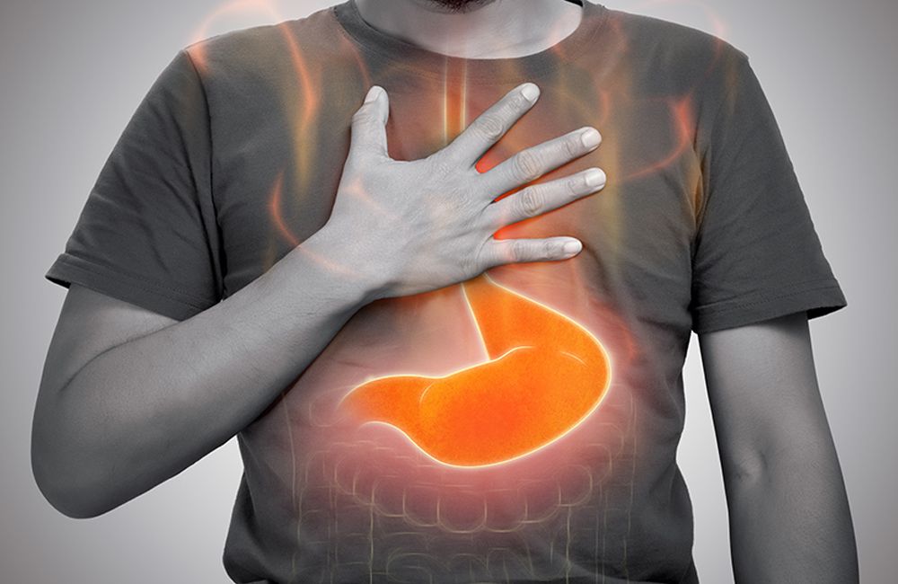 Che cos'è il Reflusso Gastroesofageo?
